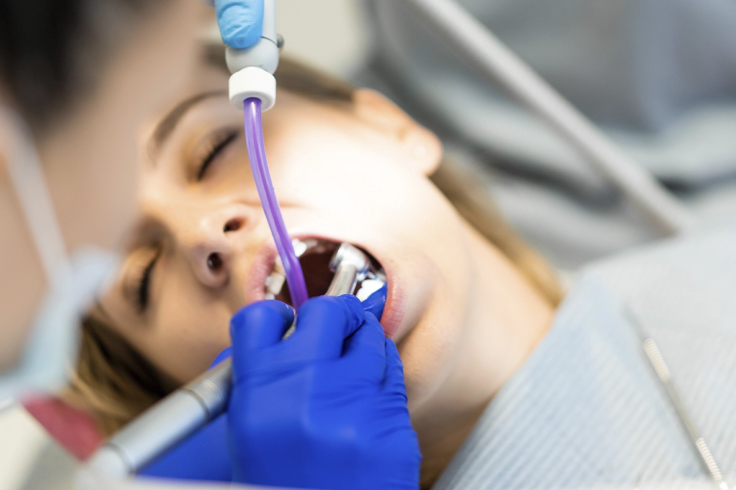 Stomatološka ordinacija Srba & Bilja – dentalne usluge